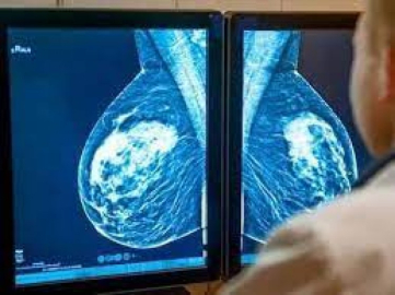 Meme Kanseri İçin Mucizevi Önlem: Mamografi