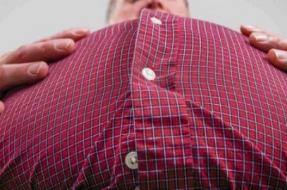 Ülkemizde 30 yaş üzerindeki her 3 kişiden 1’i obezite hastası! 